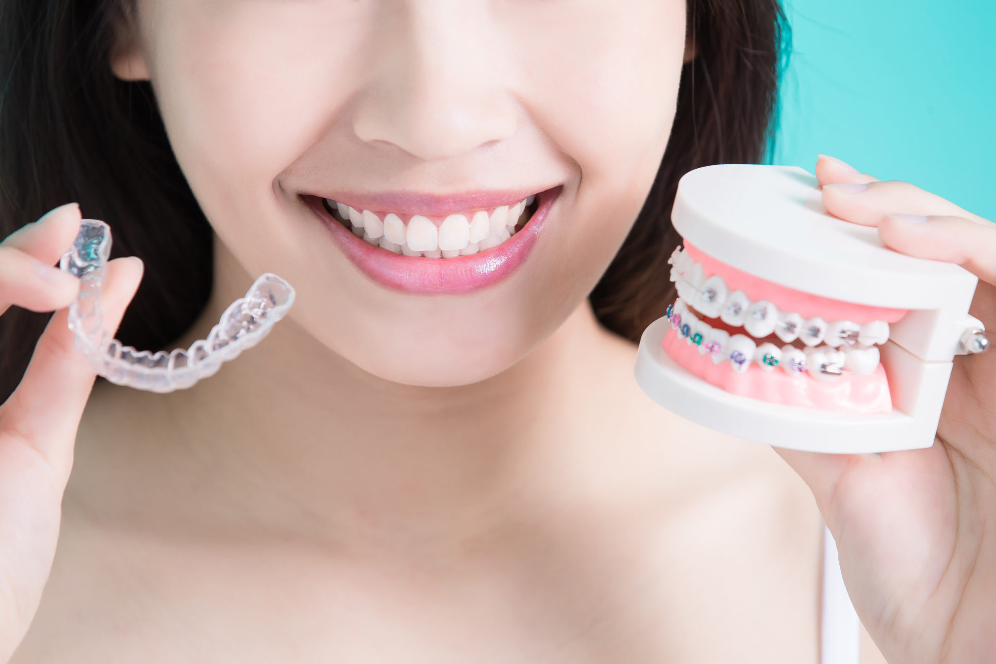 How Much Does Invisalign Cost With Dental Insurance Awesome How Much Does Invisalign Cost With Dental Insurance Awesome